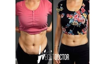 WEIGHT DOCTOR
