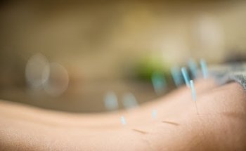 Alethea Healing Acupuncture